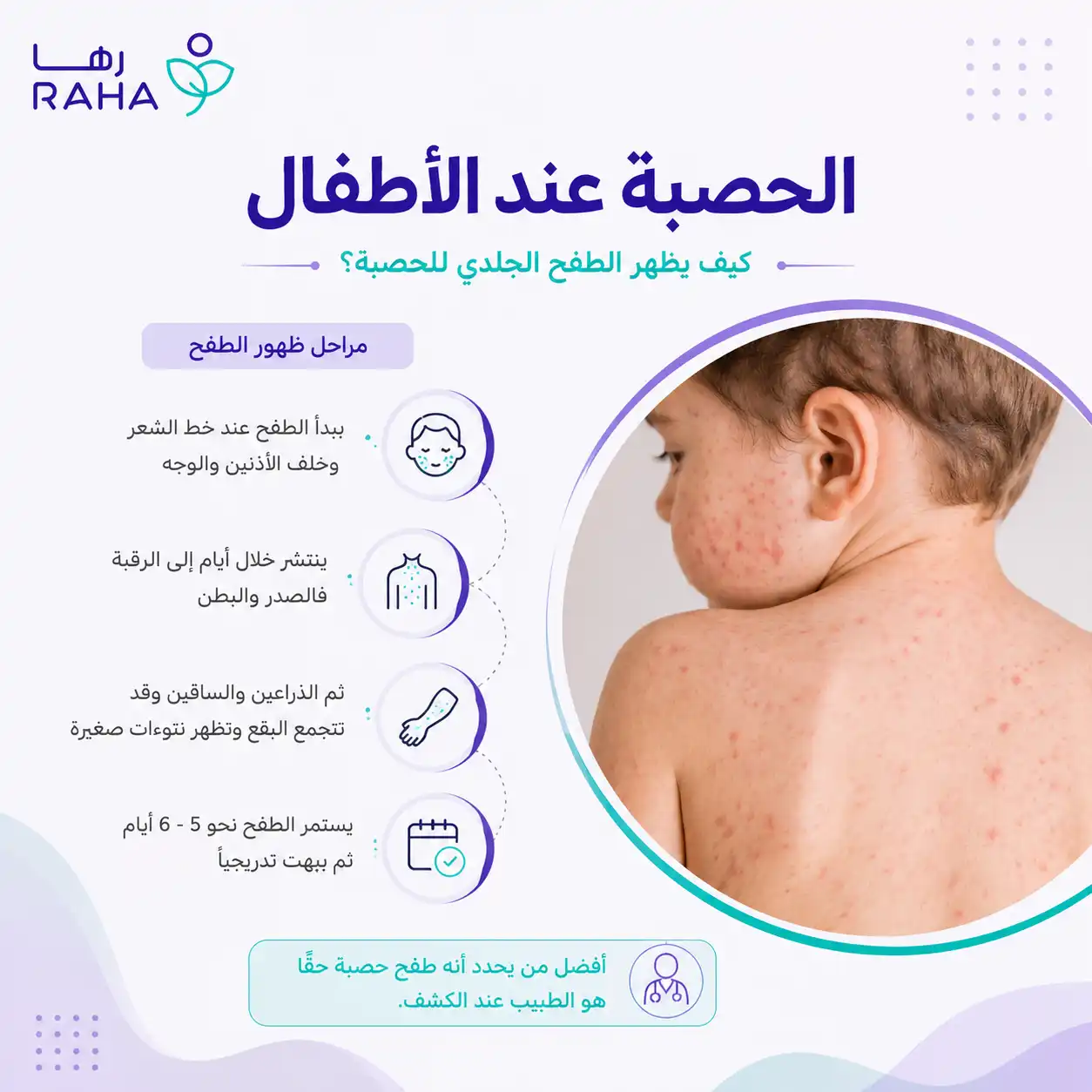 تطعيم الحصبة للاطفال